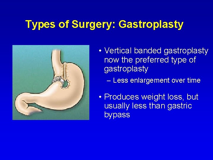 Types of Surgery: Gastroplasty • Vertical banded gastroplasty now the preferred type of gastroplasty