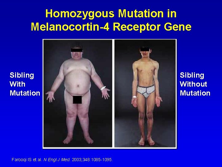 Homozygous Mutation in Melanocortin-4 Receptor Gene Sibling With Mutation Farooqi IS et al. N