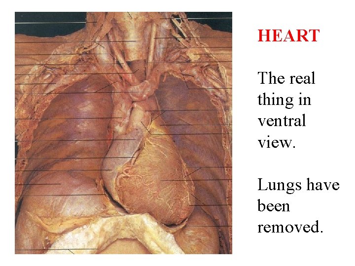 HEART The real thing in ventral view. Lungs have been removed. 