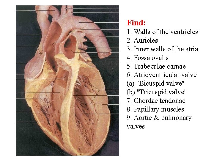 Find: 1. Walls of the ventricles 2. Auricles 3. Inner walls of the atria