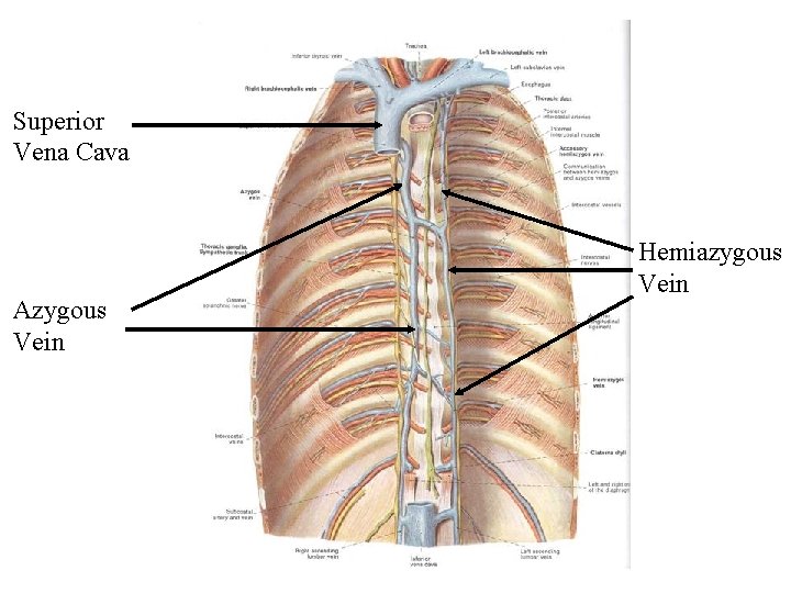 Superior Vena Cava Azygous Vein Hemiazygous Vein 