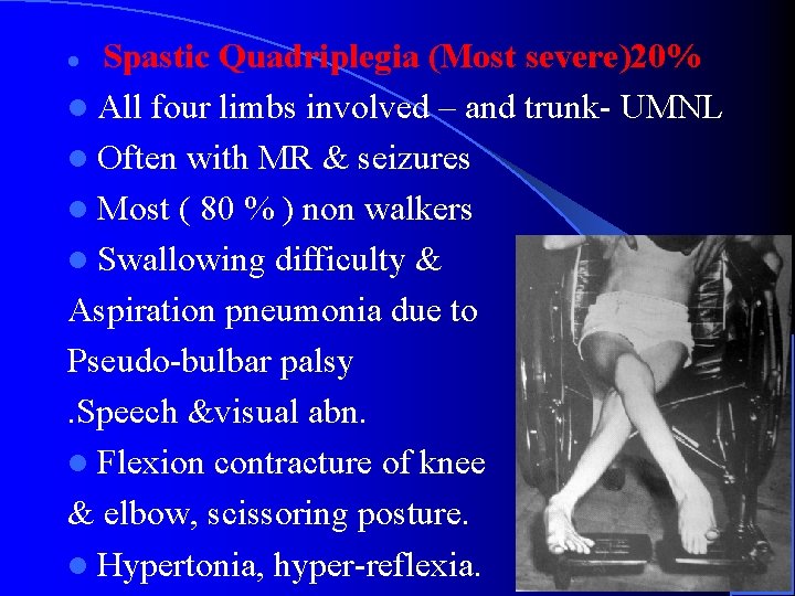 Spastic Quadriplegia (Most severe)20% l All four limbs involved – and trunk- UMNL l