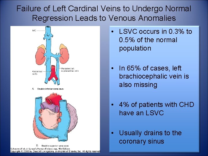 Failure of Left Cardinal Veins to Undergo Normal Regression Leads to Venous Anomalies •