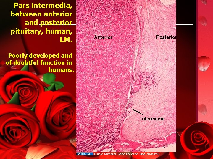 Pars intermedia, between anterior and posterior pituitary, human, LM. Anterior Posterior Poorly developed and