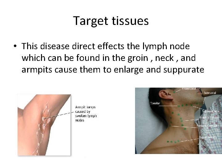 Target tissues • This disease direct effects the lymph node which can be found