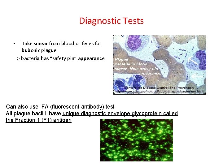 Diagnostic Tests Take smear from blood or feces for bubonic plague > bacteria has