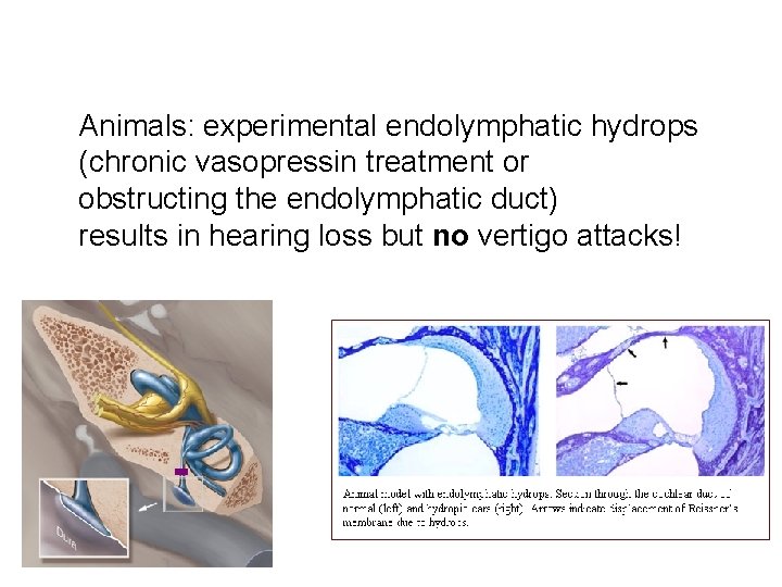 Animals: experimental endolymphatic hydrops (chronic vasopressin treatment or obstructing the endolymphatic duct) results in