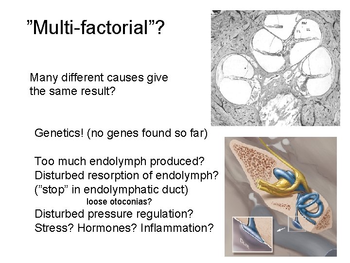 ”Multi-factorial”? Many different causes give the same result? Genetics! (no genes found so far)