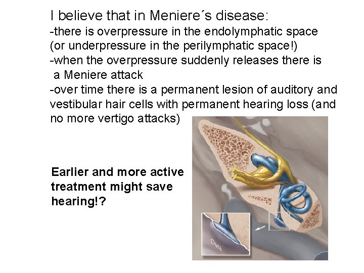 I believe that in Meniere´s disease: -there is overpressure in the endolymphatic space (or