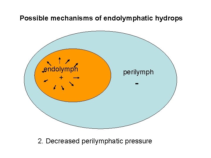 Possible mechanisms of endolymphatic hydrops endolymph + perilymph - 2. Decreased perilymphatic pressure 