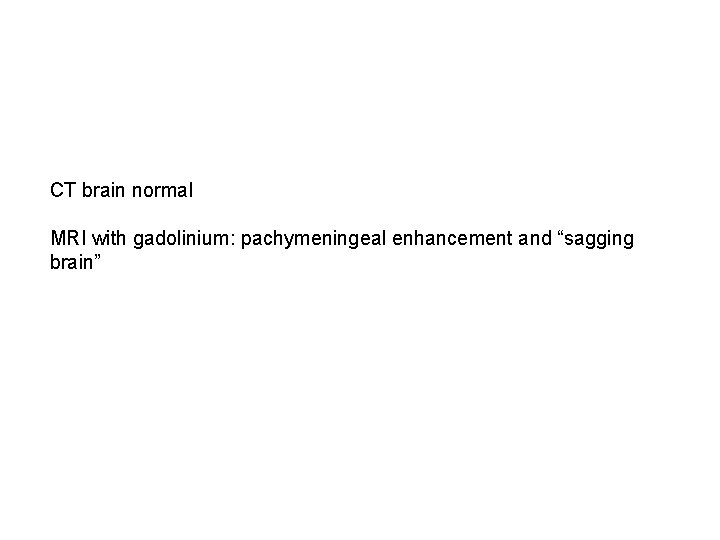 CT brain normal MRI with gadolinium: pachymeningeal enhancement and “sagging brain” 