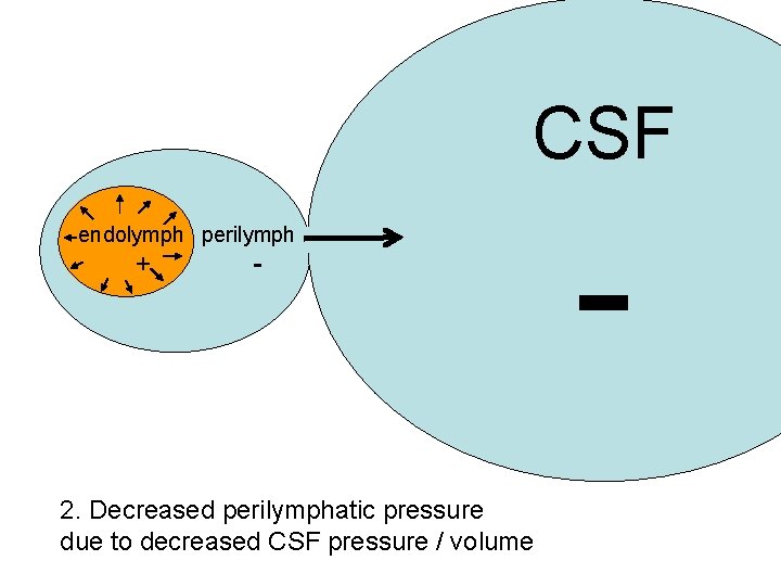 CSF endolymph perilymph + - 2. Decreased perilymphatic pressure due to decreased CSF pressure