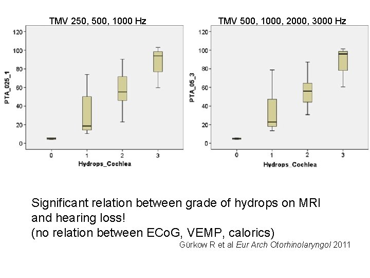 TMV 250, 500, 1000 Hz TMV 500, 1000, 2000, 3000 Hz Significant relation between