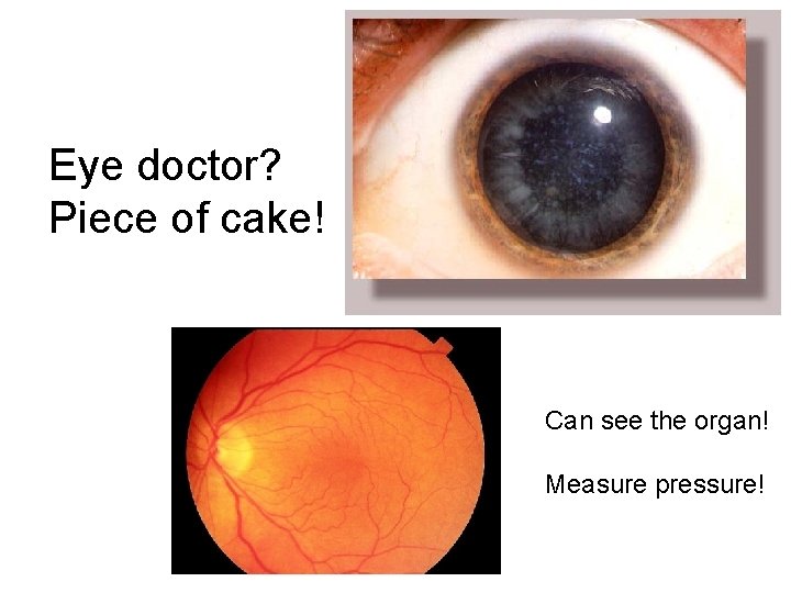 Eye doctor? Piece of cake! Can see the organ! Measure pressure! 