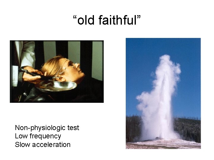 “old faithful” Non-physiologic test Low frequency Slow acceleration 