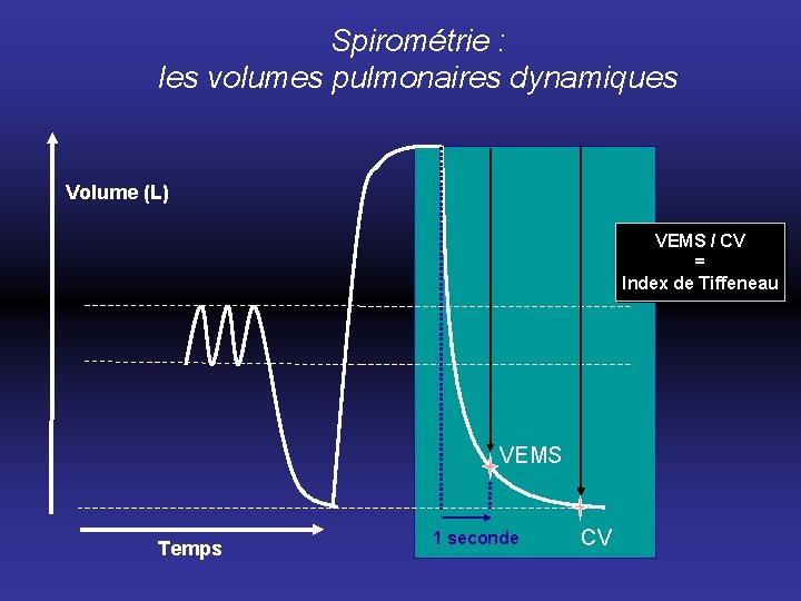 Spirométrie : les volumes pulmonaires dynamiques Volume (L) VEMS / CV = Index de