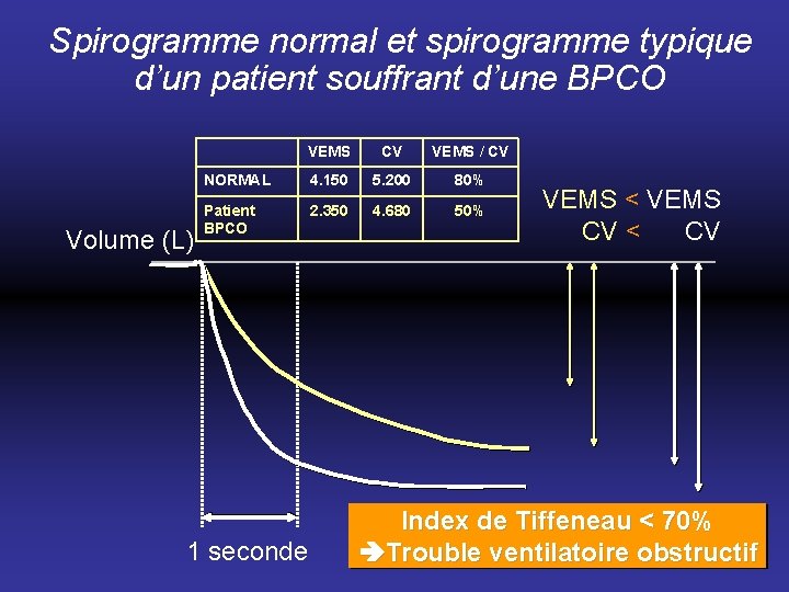 Spirogramme normal et spirogramme typique d’un patient souffrant d’une BPCO Volume (L) VEMS CV