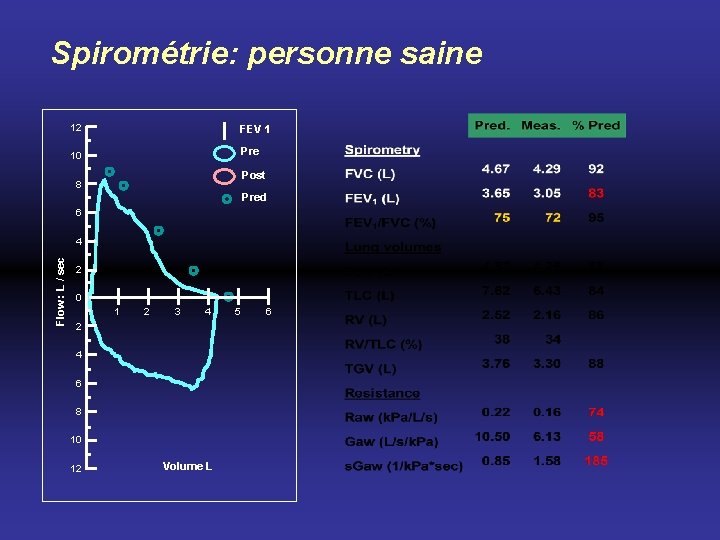 Spirométrie: personne saine 12 FEV 1 10 Pre Post 8 Pred 6 Flow :