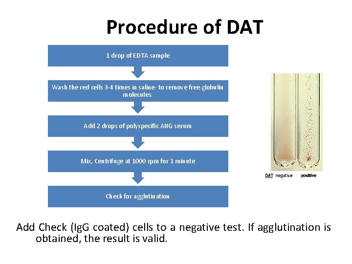 Procedure of DAT 1 drop of EDTA sample Wash the red cells 3 -4