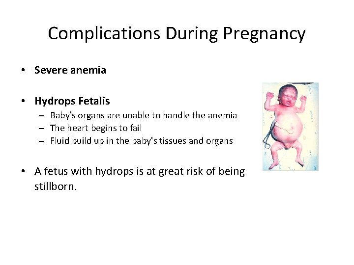 Complications During Pregnancy • Severe anemia • Hydrops Fetalis – Baby's organs are unable