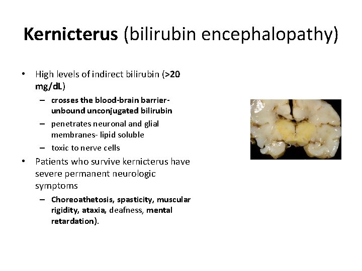 Kernicterus (bilirubin encephalopathy) • High levels of indirect bilirubin (>20 mg/d. L) – crosses Kernicterus (bilirubin encephalopathy) • High levels of indirect bilirubin (>20 mg/d. L) – crosses
