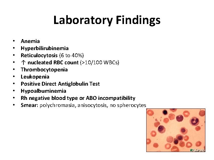 Laboratory Findings • • • Anemia Hyperbilirubinemia Reticulocytosis (6 to 40%) ↑ nucleated RBC