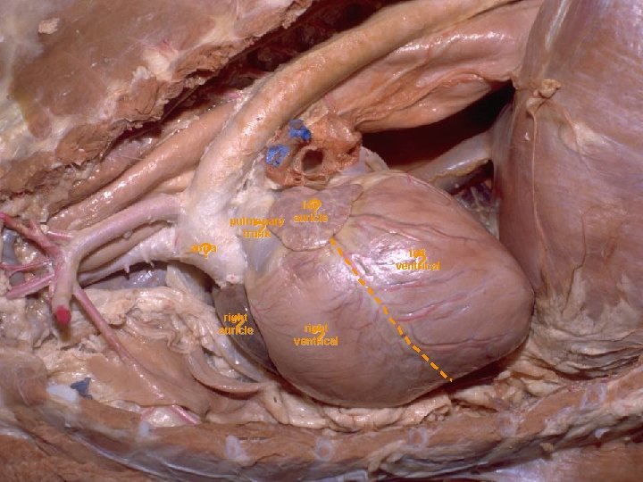 ? ? left pulmonary auricle trunk ? aorta left ventrical ? right auricle ?