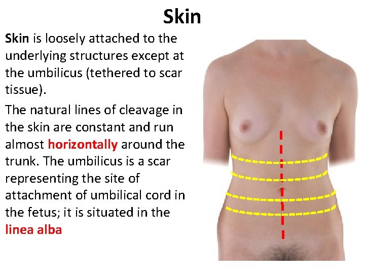 Skin is loosely attached to the underlying structures except at the umbilicus (tethered to