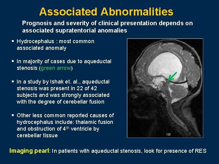 Associated Abnormalities Prognosis and severity of clinical presentation depends on associated supratentorial anomalies §