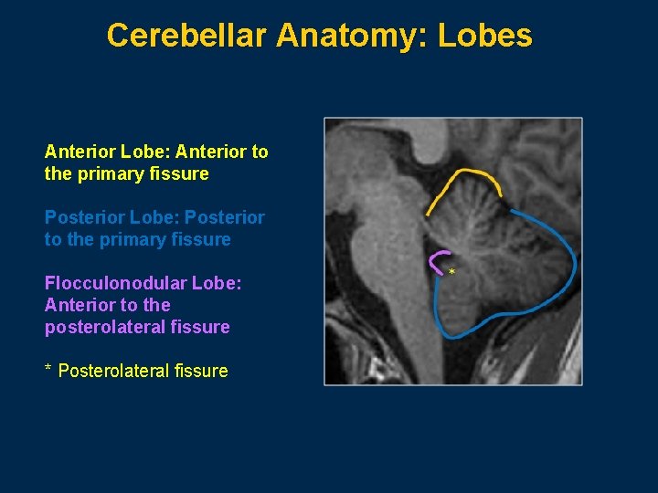 Cerebellar Anatomy: Lobes Anterior Lobe: Anterior to the primary fissure Posterior Lobe: Posterior to