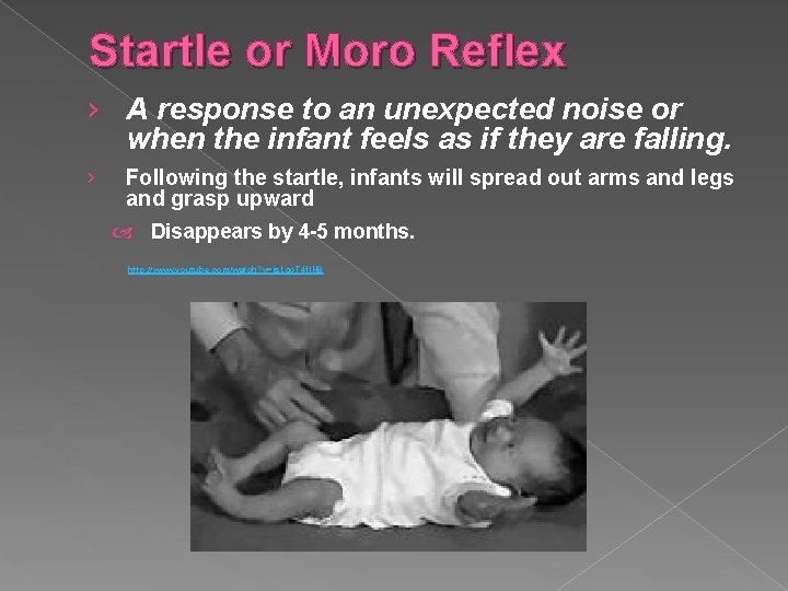 Startle or Moro Reflex › A response to an unexpected noise or when the