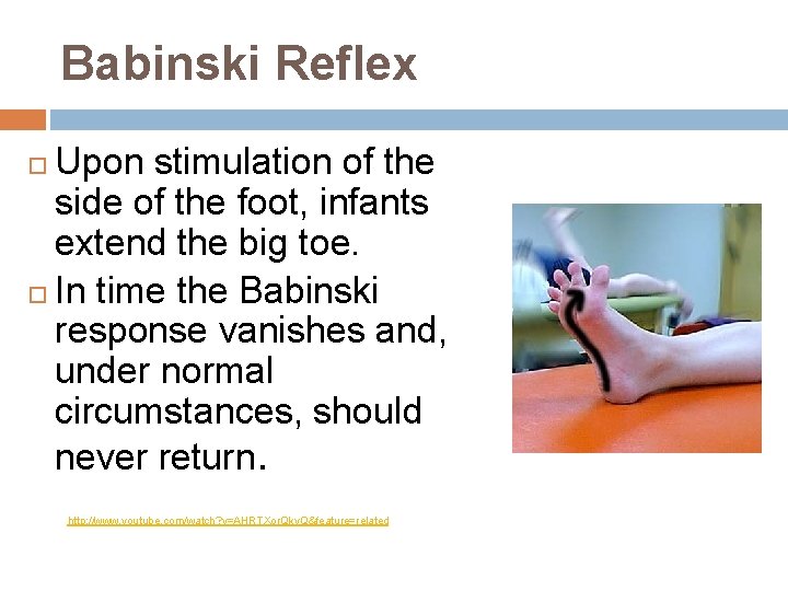 Babinski Reflex Upon stimulation of the side of the foot, infants extend the big