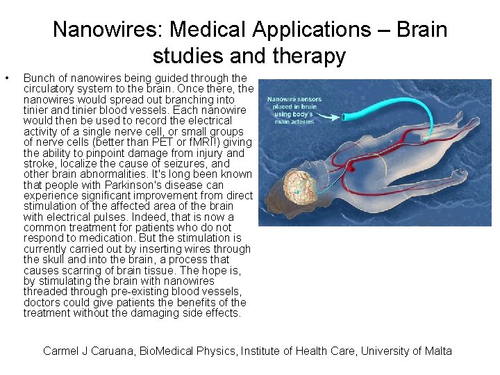 Nanowires: Medical Applications – Brain studies and therapy • Bunch of nanowires being guided