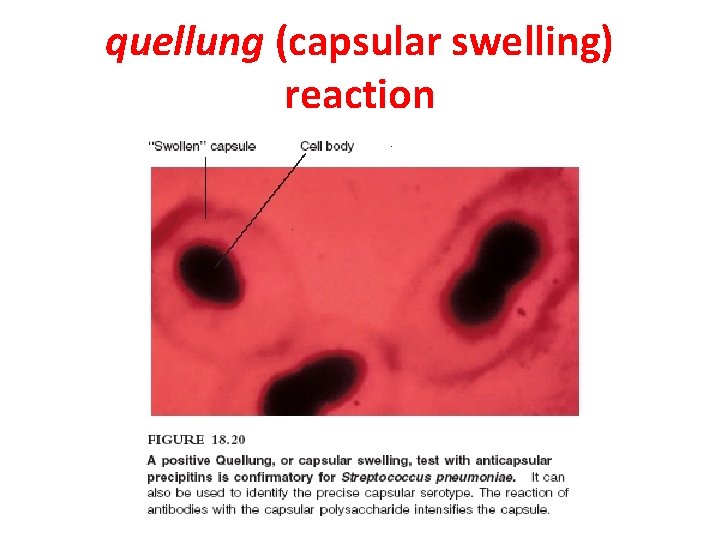 quellung (capsular swelling) reaction 
