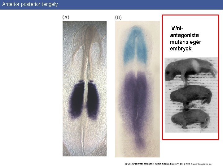 Anterior-posterior tengely Wntantagonista mutáns egér embryok 