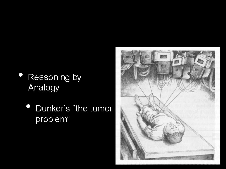  • Reasoning by Analogy • Dunker’s “the tumor problem” 