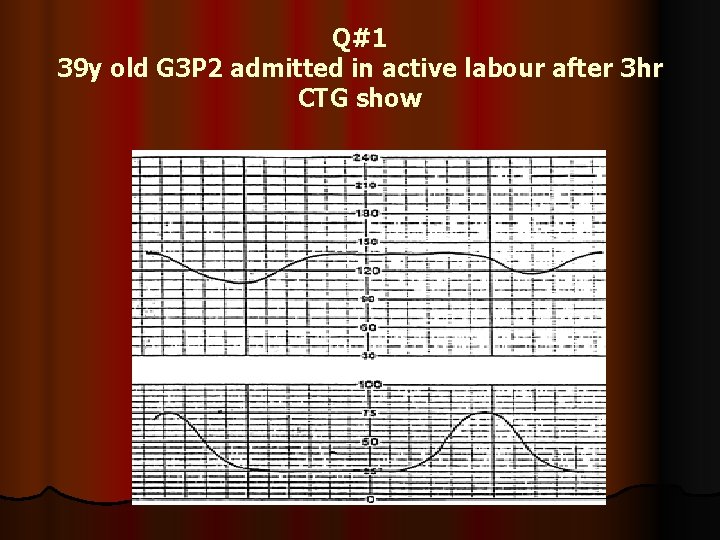 Q#1 39 y old G 3 P 2 admitted in active labour after 3