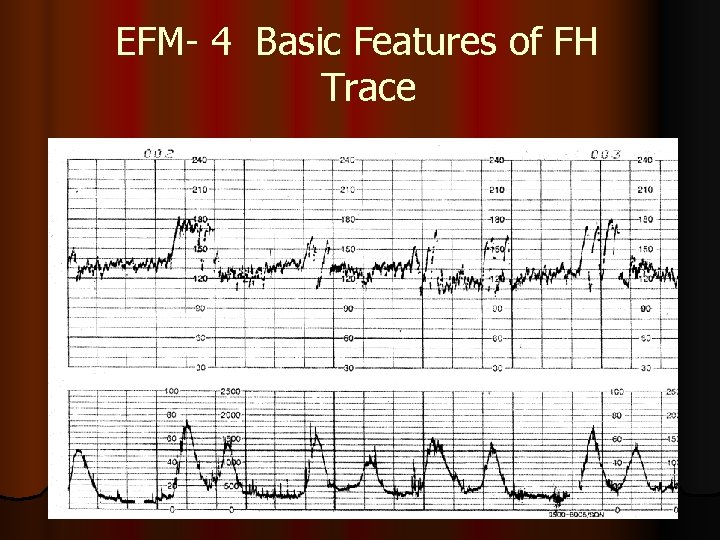 EFM- 4 Basic Features of FH Trace 