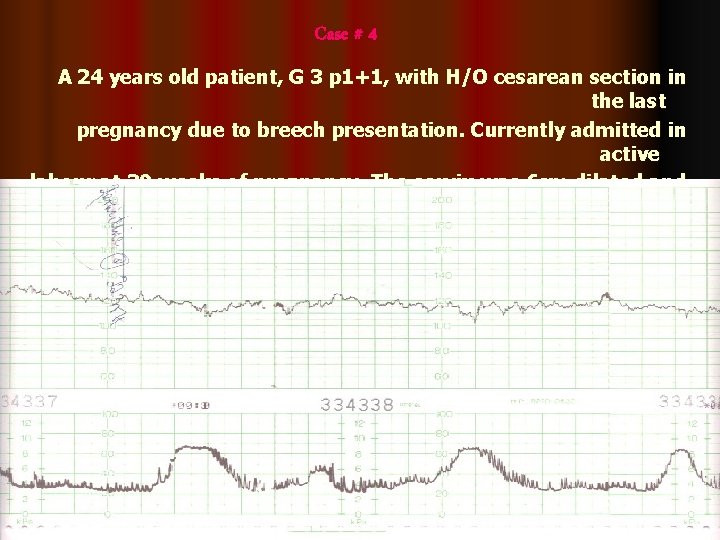 Case # 4 A 24 years old patient, G 3 p 1+1, with H/O