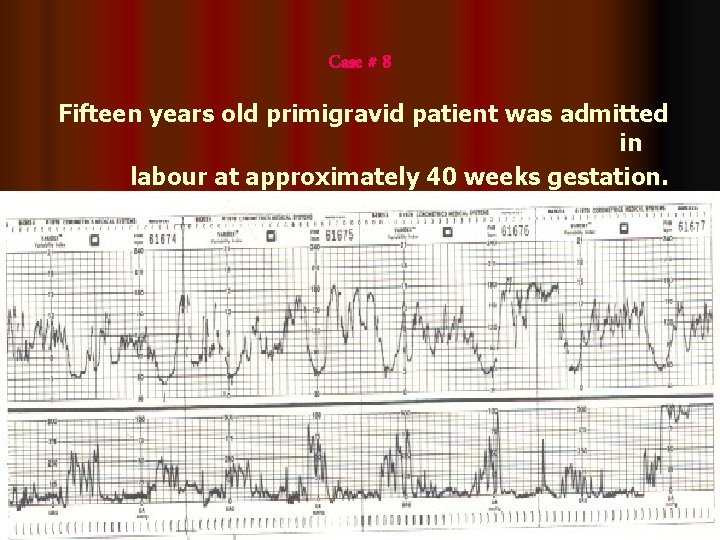 Case # 8 Fifteen years old primigravid patient was admitted in labour at approximately