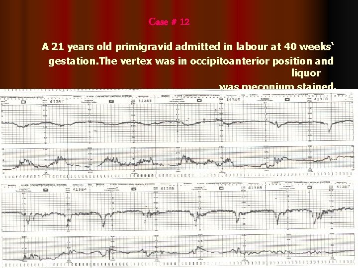 Case # 12 A 21 years old primigravid admitted in labour at 40 weeks‘