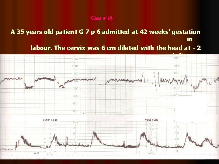 Case # 13 A 35 years old patient G 7 p 6 admitted at