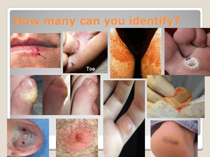 How many can you identify? Toe 