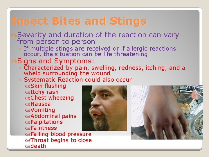 Insect Bites and Stings Severity and duration of the reaction can vary from person
