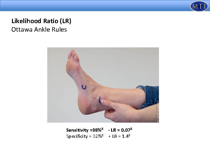 Likelihood Ratio (LR) Ottawa Ankle Rules Sensitivity =98%8 - LR = 0. 078 Specificity