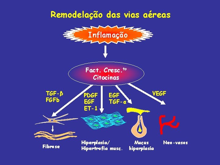 Remodelação das vias aéreas Inflamação Fact. Cresc. to Citocinas TGF-β FGFb Fibrose PDGF ET-1