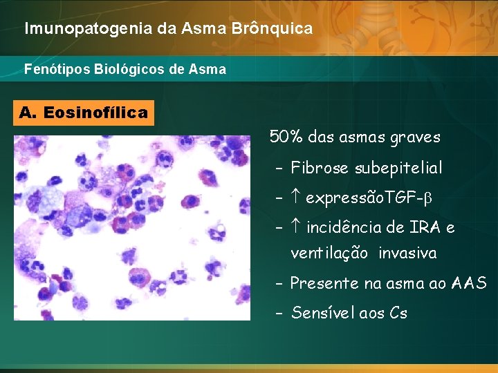 Imunopatogenia da Asma Brônquica Fenótipos Biológicos de Asma A. Eosinofílica 50% das asmas graves