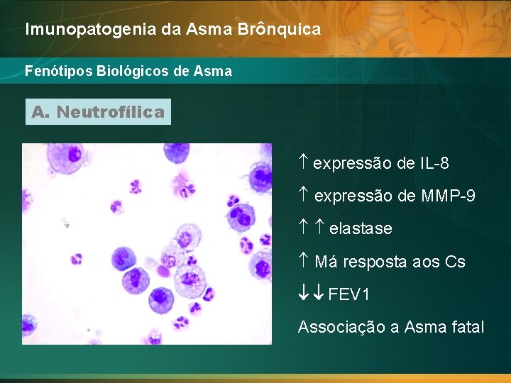 Imunopatogenia da Asma Brônquica Fenótipos Biológicos de Asma A. Neutrofílica expressão de IL-8 expressão