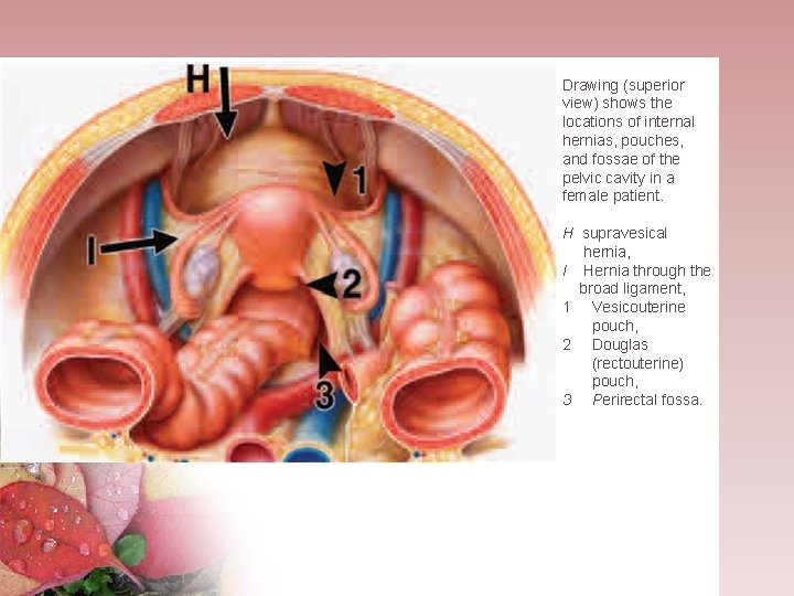 Drawing (superior view) shows the locations of internal hernias, pouches, and fossae of the