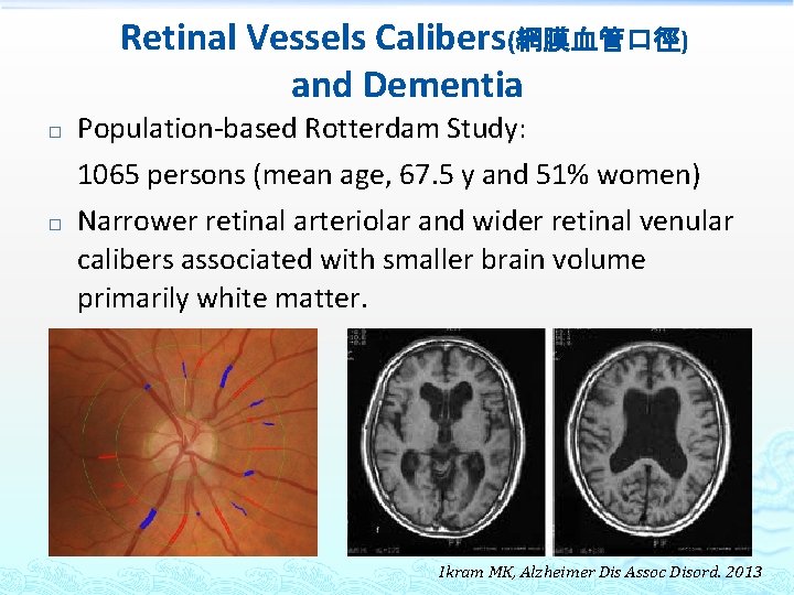Retinal Vessels Calibers(網膜血管口徑) and Dementia � � Population-based Rotterdam Study: 1065 persons (mean age,